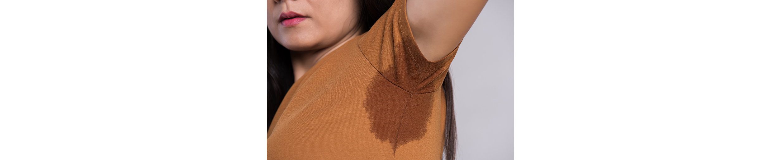 Hiperhidrosis