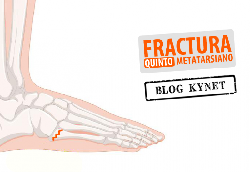 Medicina del Deporte