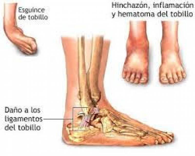 ligamentos y huesos del tobillo